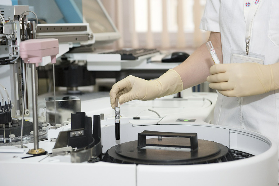 Badania laboratoryjne przydatne w diagnozie i monitorowaniu przebiegu choroby Hashimoto