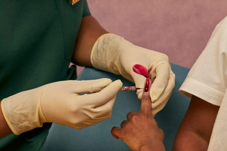 Anemia a niedoczynność tarczycy